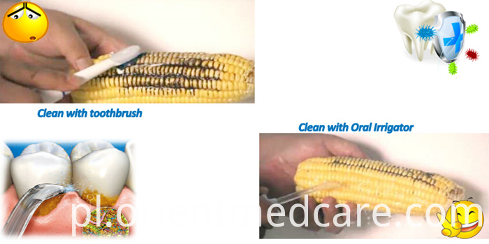 Revolution of oral water flosser Revolution of oral water flosser